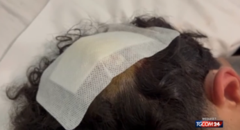 Ferito in testa nella sparatoria di Monreale: “Pensavo di morire”